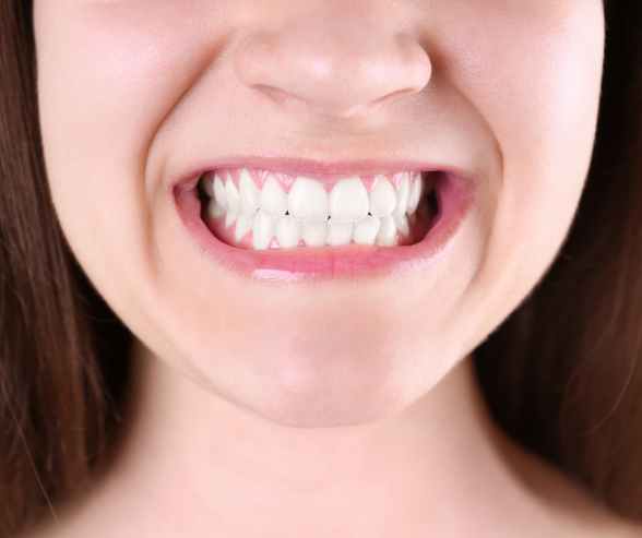 Teeth Grinding Symptoms
