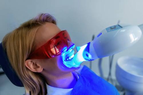 Smile Perfected blue LED light activating whitening gel